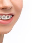 Orthodontic CE Courses